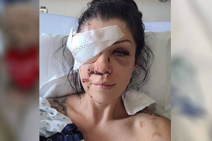 Regina Hampson, who was shot in the face while intervening in a mental health crisis in a north Nanaimo home on Saturday, is now in hospital in Vancouver. (Photo submitted)