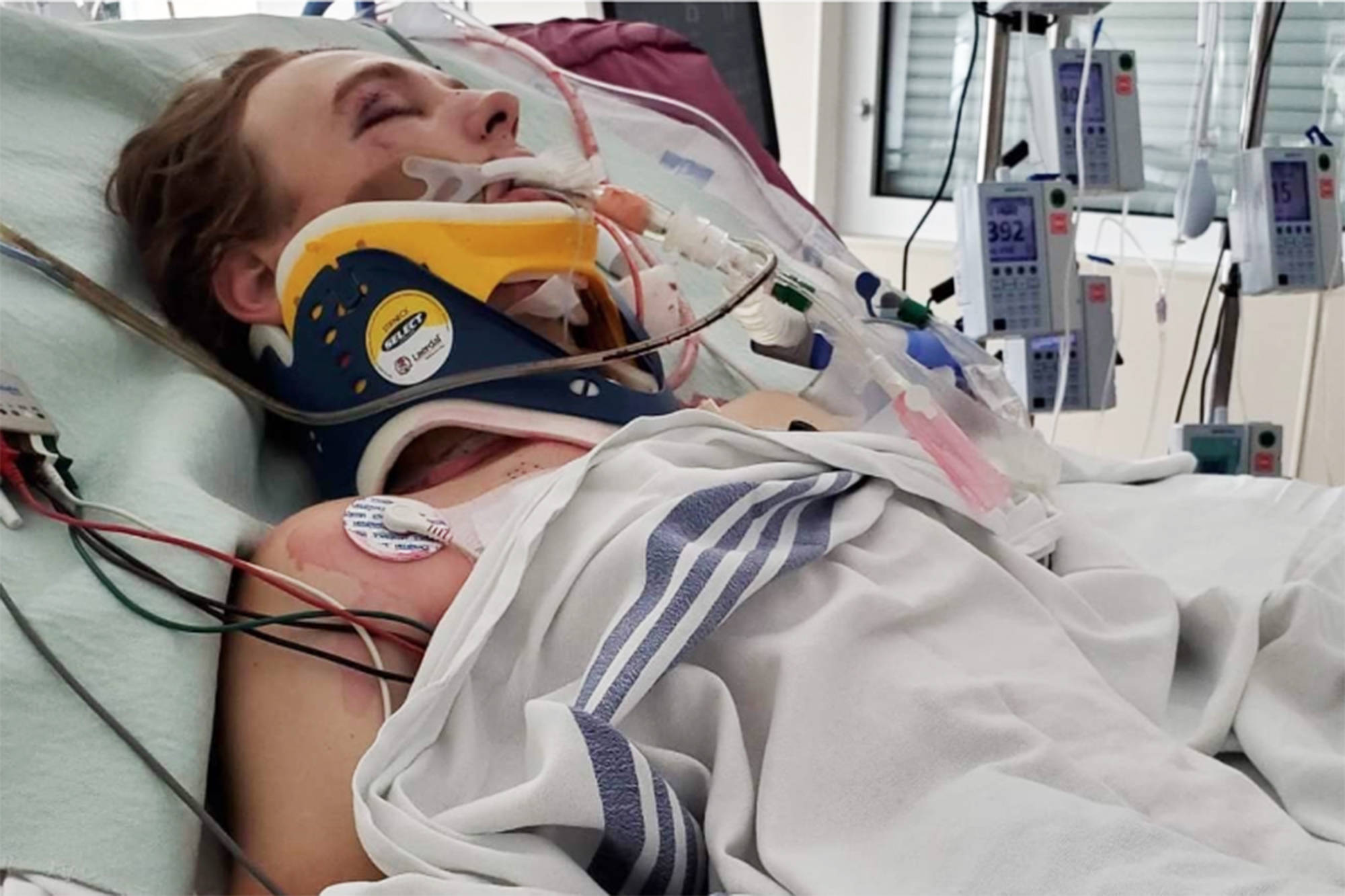 Colby Kalke remains in intensive care at Royal Inland Hospital following a June 3 motor-vehicle collision. (Colby Yost/Gofundme photo)