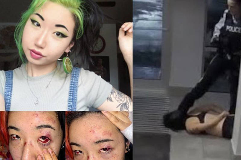 Photos of Mona Wang, the injuries she sustained and a still from surveillance footage of Const. Lacey Browning pushing her head into the ground with a boot. (Contributed)