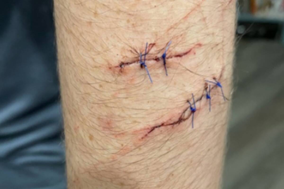 A Kamloops mother said her son was taunted, punched and kicked, made to walk like a dog and, most seriously, forced to cut his own arm with a knife he carries. She said the attack occurred this past Saturday at Overlander Beach. The Kamloops RCMP confirmed three youths were arrested and that the investigation is proceeding.
Photograph By KTW