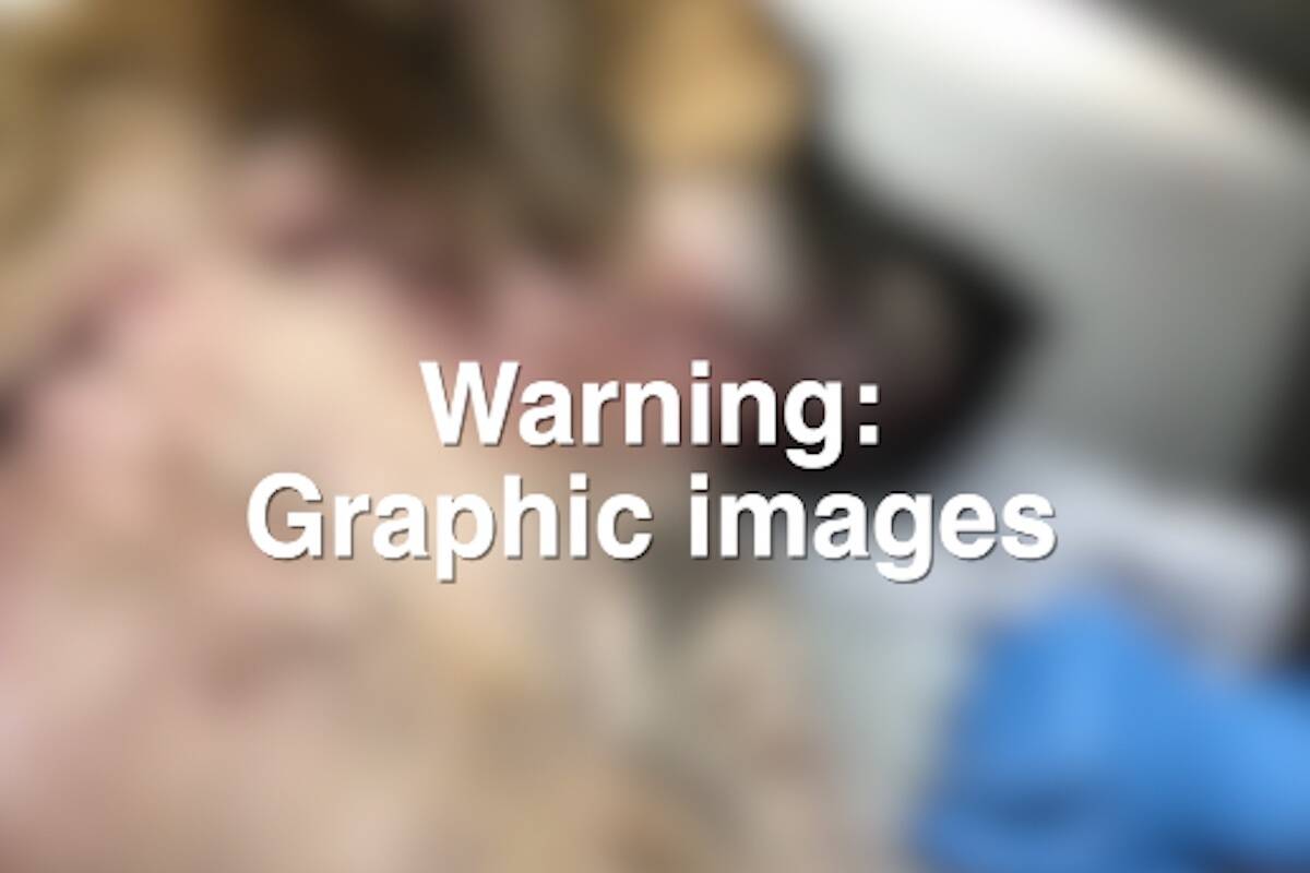 WARNING: Graphic Images