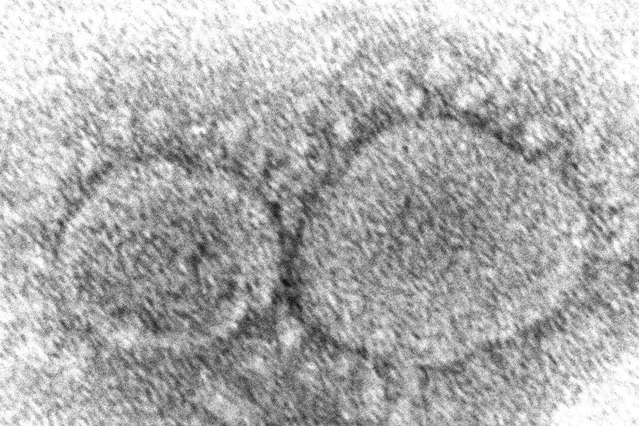 FILE - This 2020 electron microscope image made available by the Centers for Disease Control and Prevention shows SARS-CoV-2 virus particles, which cause COVID-19. A crucial question has eluded governments and health agencies since the COVID-19 pandemic began: Did the virus originate in animals or leak from a Chinese lab? Now, the U.S. Department of Energy has assessed with “low confidence” that it began with a lab leak although others in the U.S. intelligence community disagree. (Hannah A. Bullock, Azaibi Tamin/CDC via AP, File)
